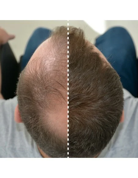 Bifull - Nano Fibers Light Brown Fibers with Keratin 100 ml + 25 g - BFEXT43307