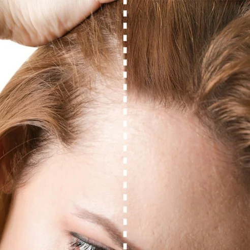 Bifull - Nano Fibers Light Brown Fibers with Keratin 100 ml + 25 g - BFEXT43307