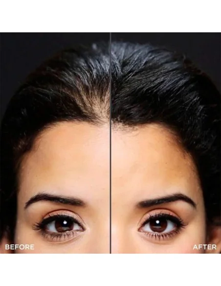 Toppik - Hairline Optimizer - 1 unit